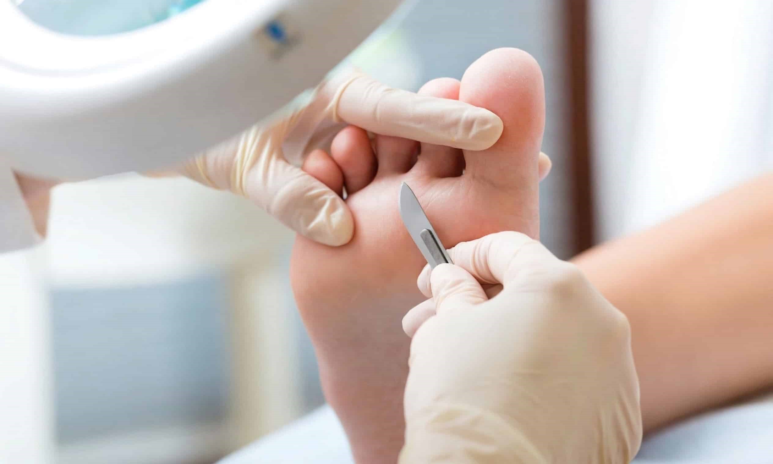 Soin de pédicurie médicale