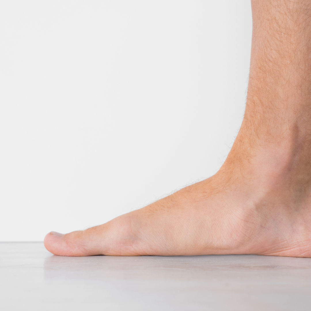 Déformations du pied